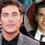 Zac Efron Jaw Injury In Accident