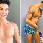 Botched Justin Plastic Surgery