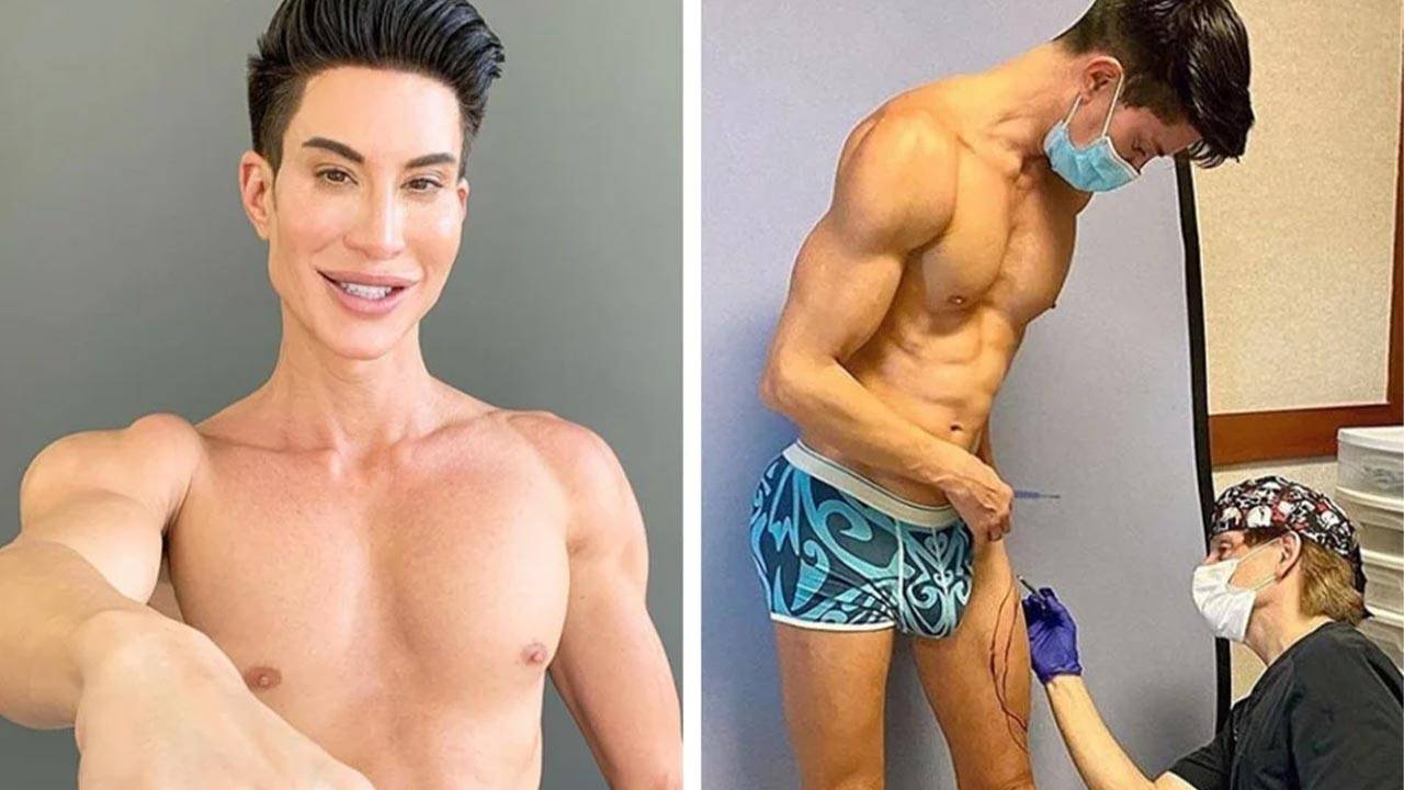 Botched Justin Plastic Surgery, Human Ken Doll Justin Jedlica Before