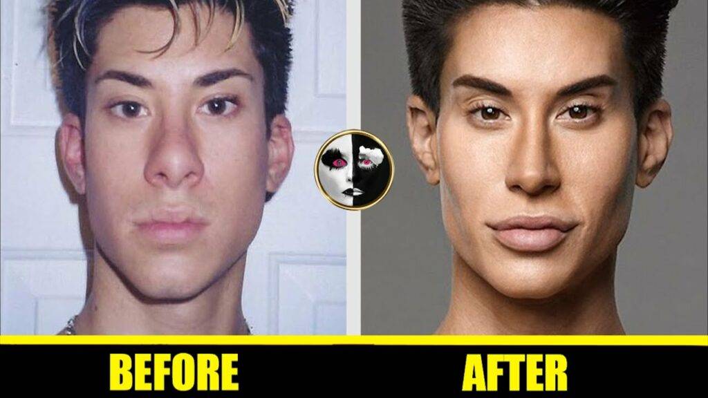 Human Ken Doll Justin Jedlica Before And After Surgery