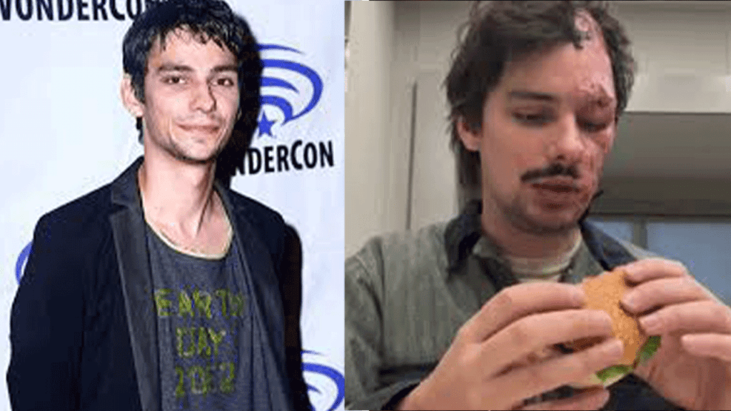 Devon Bostick Face