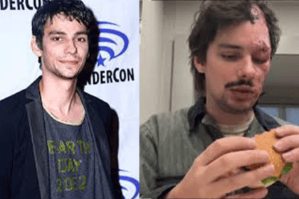 Devon Bostick Face