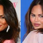 Chrissy Teigen Plastic Surgery
