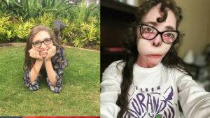 Jacqueline Durand Dog Attack, Here's How She Survived 800 Bites of Dogs