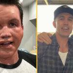 Rob Mcelhenney Allergic Reaction Nut Allergy