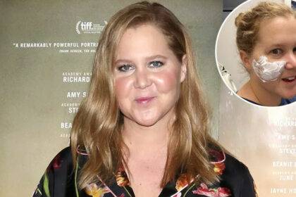 Amy Schumer Cheeks And Fat Face