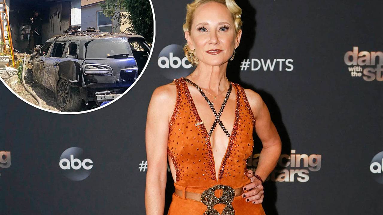 Anne Heche Death: Anne Heche Cause of Death, How Did Anne Heche Die
