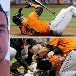 Giancarlo Stanton Face Injury