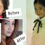 Kristel Fulgar Befor And Now
