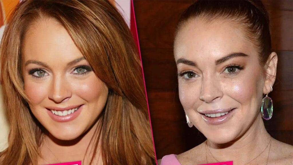 Lindsay Lohan After and Before 